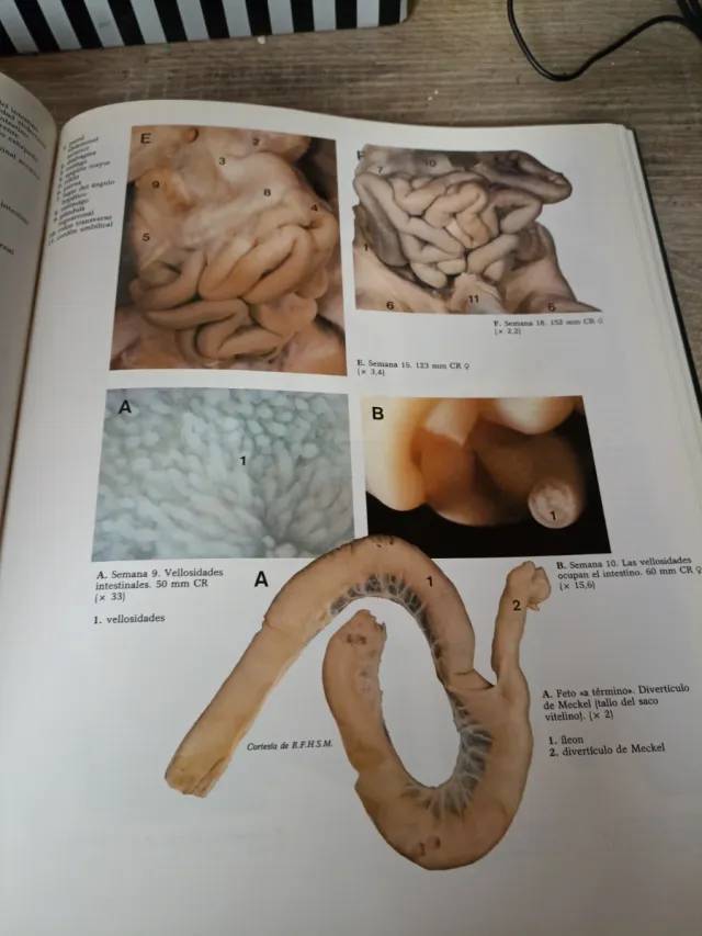 Atlas en Couleurs de la Vie Avant la Naissance ...