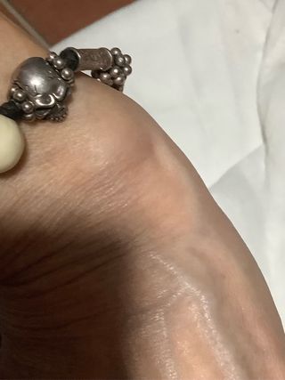 Parure Anello e Bracciale Teschio Nero Argento