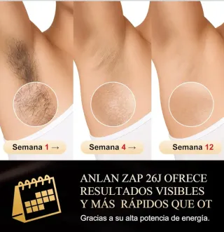 Depiladora ANLAN 26J Láser Indolora