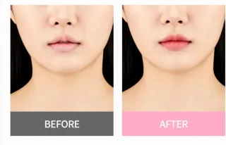 Bálsamo Labial Atomy Lip Glow Rosa