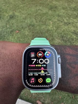Apple Watch Ultra 3 + Applecare