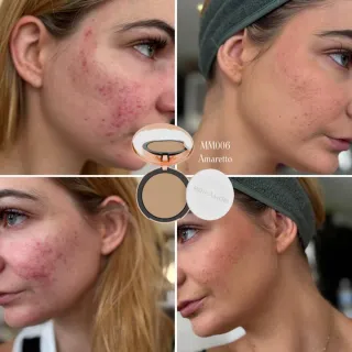 Gel facial purificante con ácido salicílico