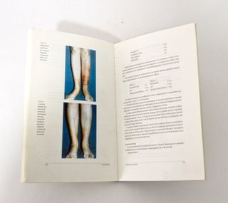 TRATADO DE MESOTERAPIA