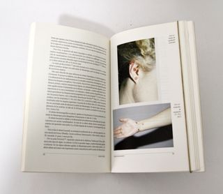 TRATADO DE MESOTERAPIA