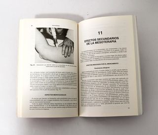 MESOTERAPIA EN MEDICINA GENERAL