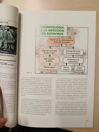 Gastroenteritis agudas. Deshidratación en niños