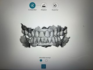 Escáner Intraoral Carestream CS 3600