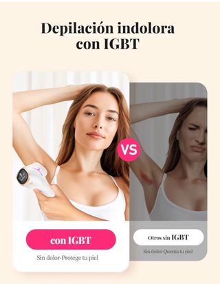 Depiladora IPL Sem Dor Rosa e Branca