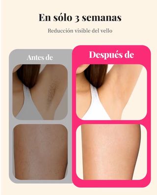 Depiladora IPL Sem Dor Rosa e Branca