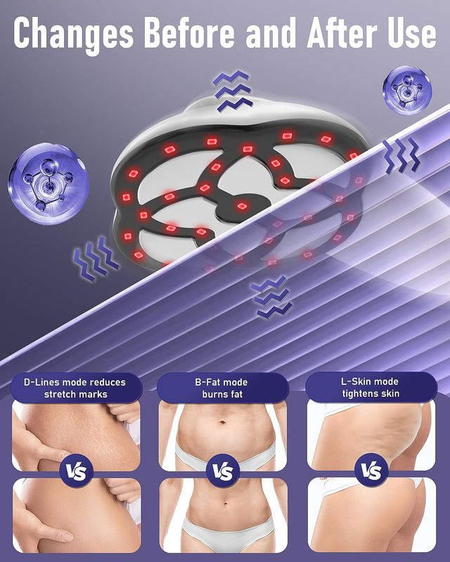 Masajeador Anticelulítico Reductor 15 Niveles