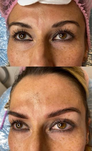 Microblading: Sombreado o pelo a pelo