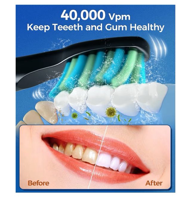 Spazzolino da Denti Elettrico Sonico