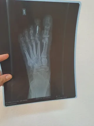 Fisioterapia profesional