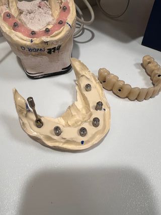 Tocadiscos Telefunken Mueble Madera