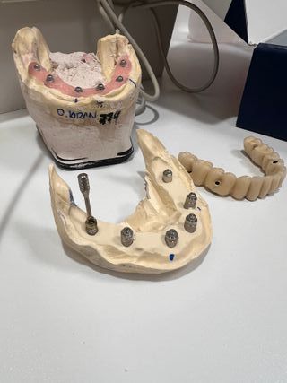 Tocadiscos Telefunken Mueble Madera