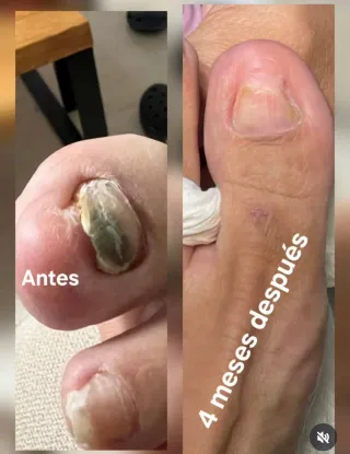 MANICURA PROFESIONAL