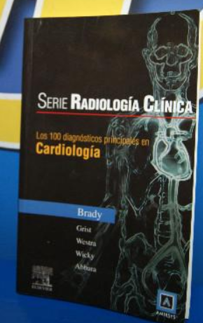 4 libri di medicina, cardiologia: Sindrome Aortica Acuta - Auscultazione Cardiaca Facile - manuale e altro