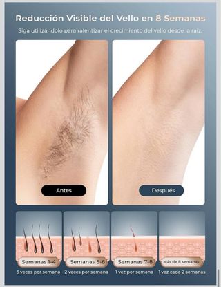 Depiladora IPL 21J Rosa y Blanca