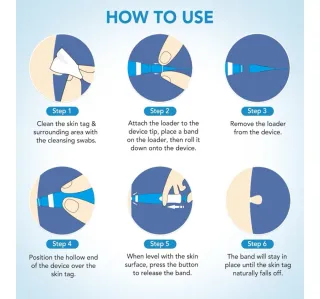 Kit removedor automático de verrugas