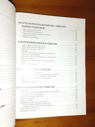 Libro de medicina Tuberculosis