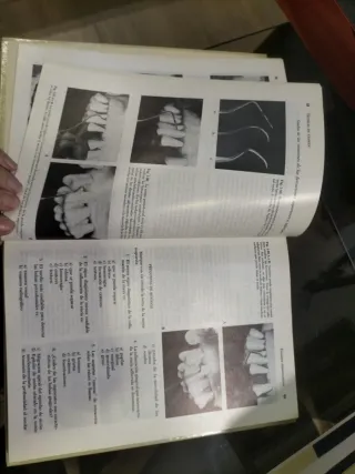 Instrumentación en Periodoncia