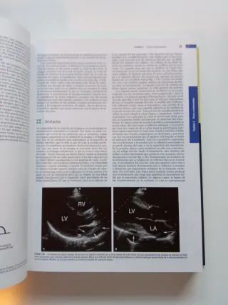 Ecocardiografía 7ª Edición Feigenbaum