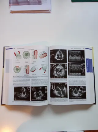Ecocardiografía 7ª Edición Feigenbaum