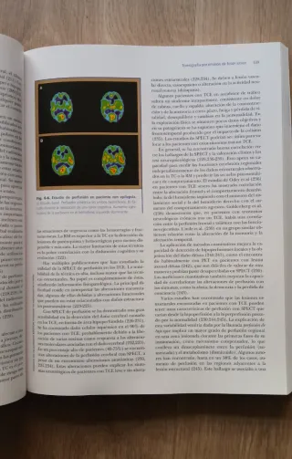 Neuroimagen. Técnicas y procesos cognitivos.