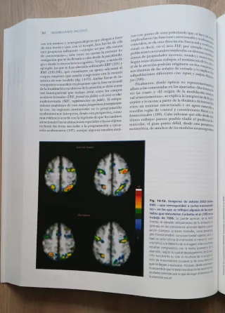 Neuroimagen. Técnicas y procesos cognitivos.