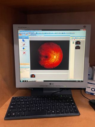 Retinógrafo Topcon TRC-NW200.