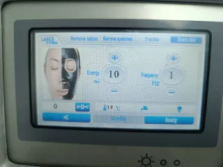 Láser Nd-yag QSwitch