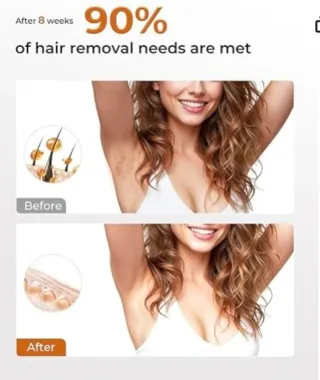 piladora IPL 9 niveles de energía oro blanco