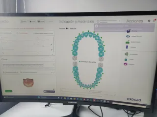 Asesoría técnica especializada Exocad