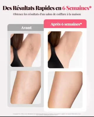 Depiladora Láser NUEVA