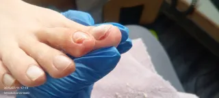 Quiropodia, Le Pied.