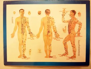 Coppette Terapia Medicina Cinese