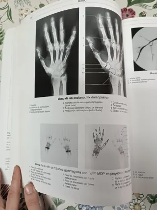 Bases Anatómicas del Diagnóstico por Imagen