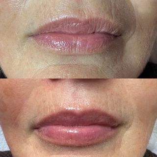 BB lips hidratacion de labios