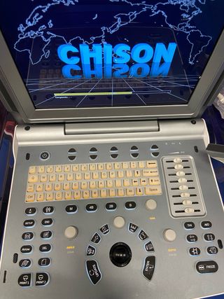 Ultrasonido Chison Eco 6