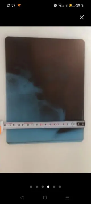 Radiografías Cráneo y Mandíbula