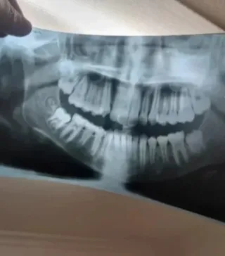 Radiografías Cráneo y Mandíbula