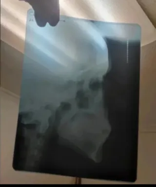 Radiografías Cráneo y Mandíbula