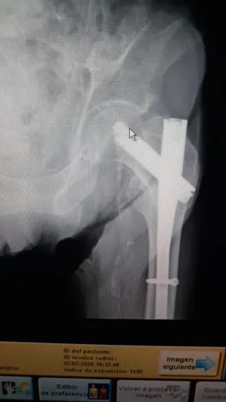 Reveladora Digital Carestream DirectView Max CR