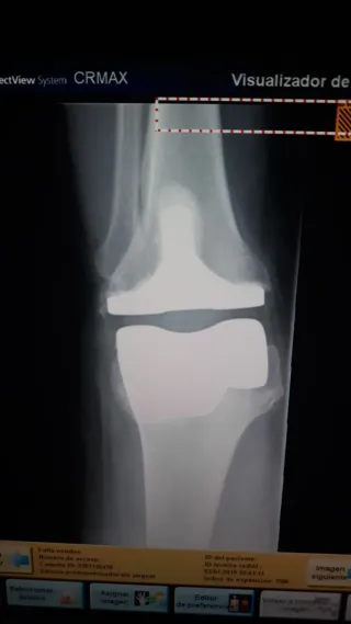 Reveladora Digital Carestream DirectView Max CR