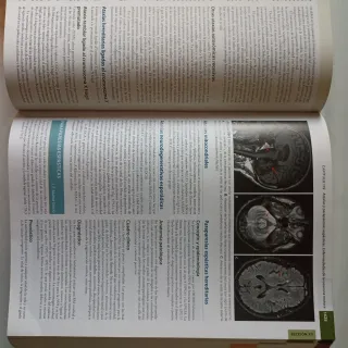 Farreras Rozman. Medicina Interna