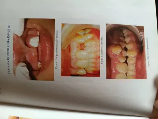 Odontoestomatología para TCAES
