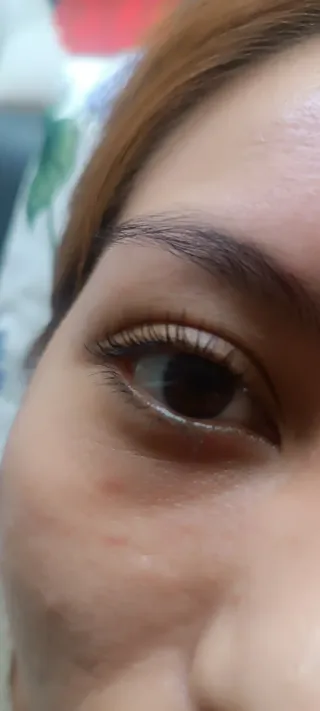 Lifting coreano y laminación de cejas