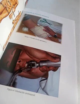 Atención de Enfermería al paciente con quemaduras