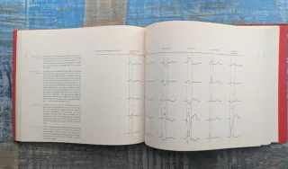 Guía de Síntomas Cardíacos