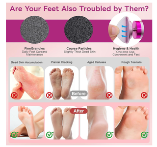 Rimozione Calli Elettrico Ricaricabile